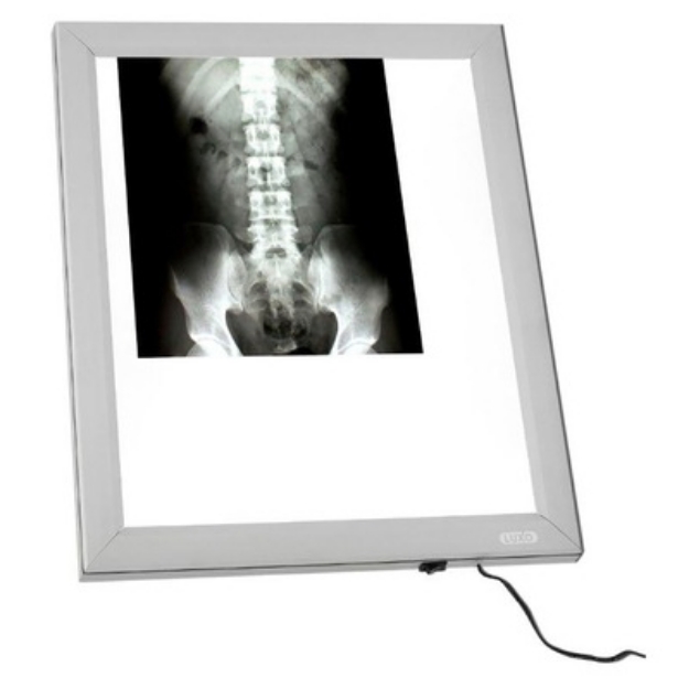Picture of Negativoscopio verticale X-ray a LED - Chinesport XUL005