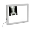 Picture of Negativoscopio verticale X-ray a LED - Chinesport XUL005